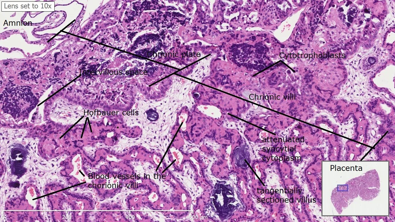 Плодное яйцо гистология. Плодное яйцо гистология. Результаты гистологии после замершей беременности. Элементы плодного яйца гистология. Плацента человека плодная часть препарат гистология.