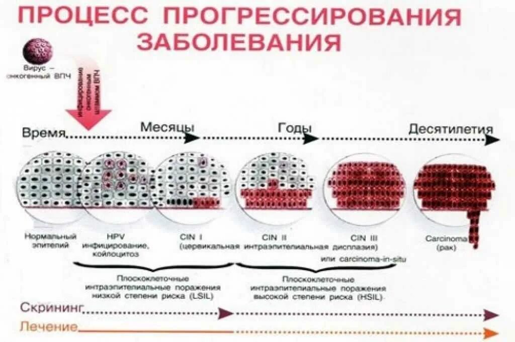 16 тип вируса впч. Вирус папилломы человека (hpv) тип 16. вирус папилломы человека 16 и 18 типа.