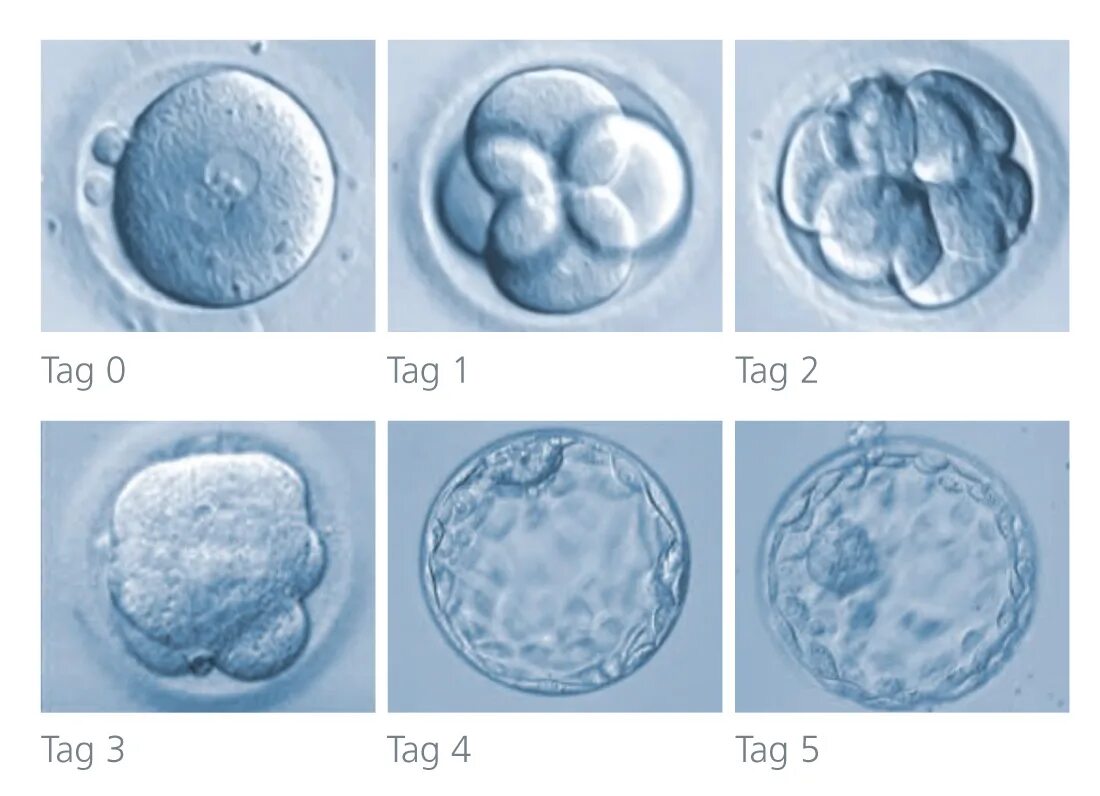 Эмбрион после пересадки. Эмбрион бластоциста. Морула бластоциста. Бластоциста морула эмбрион. Бластоциста на 5 день.