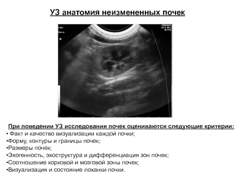 Узи лоханки почки. УЗИ почек методика исследования. Расширение ЧЛС почек на УЗИ. Эхоструктура почки. Повышенной эхогенности почки на УЗИ.