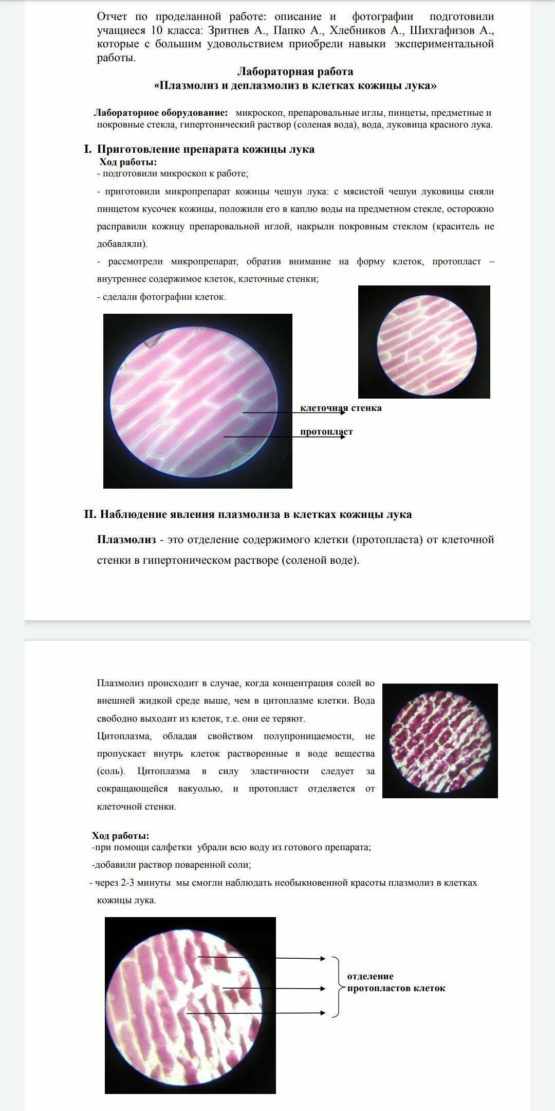 Наблюдение за плазмолизом в клетках. Тургор плазмолиз деплазмолиз. Плазмолиз лабораторная работа 10 класс.