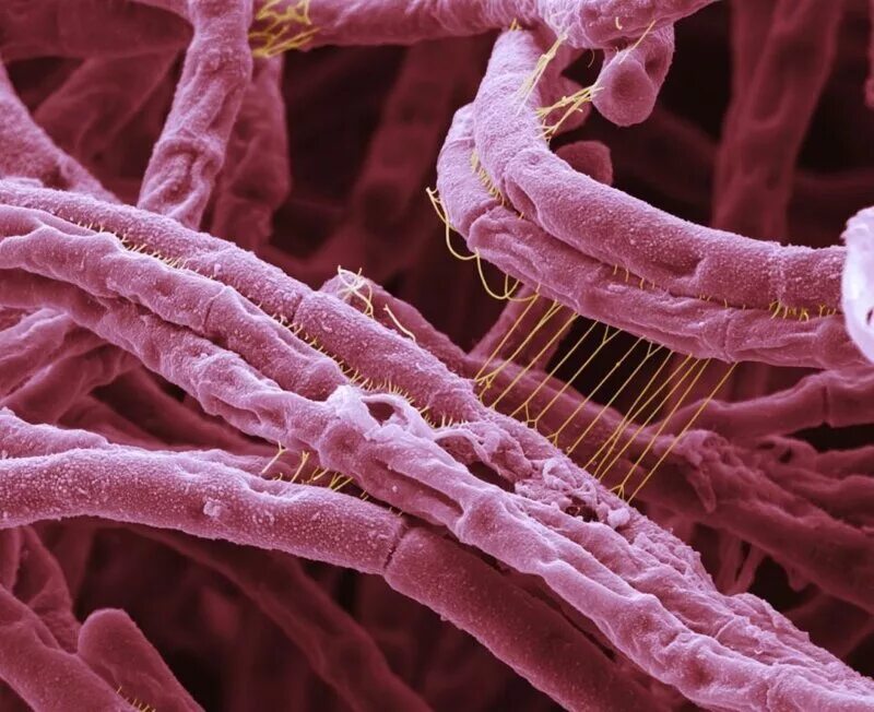 Bacillus anthracis. Bacillus anthracis, а22 (Сибирская язва). Клетка язвы