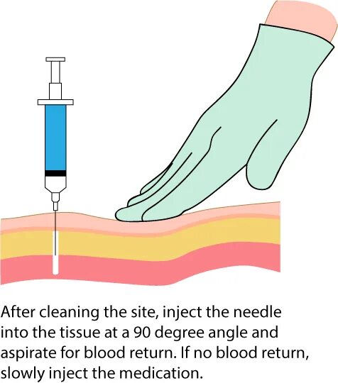 How to inject wave. Injection needles spectroscopy.