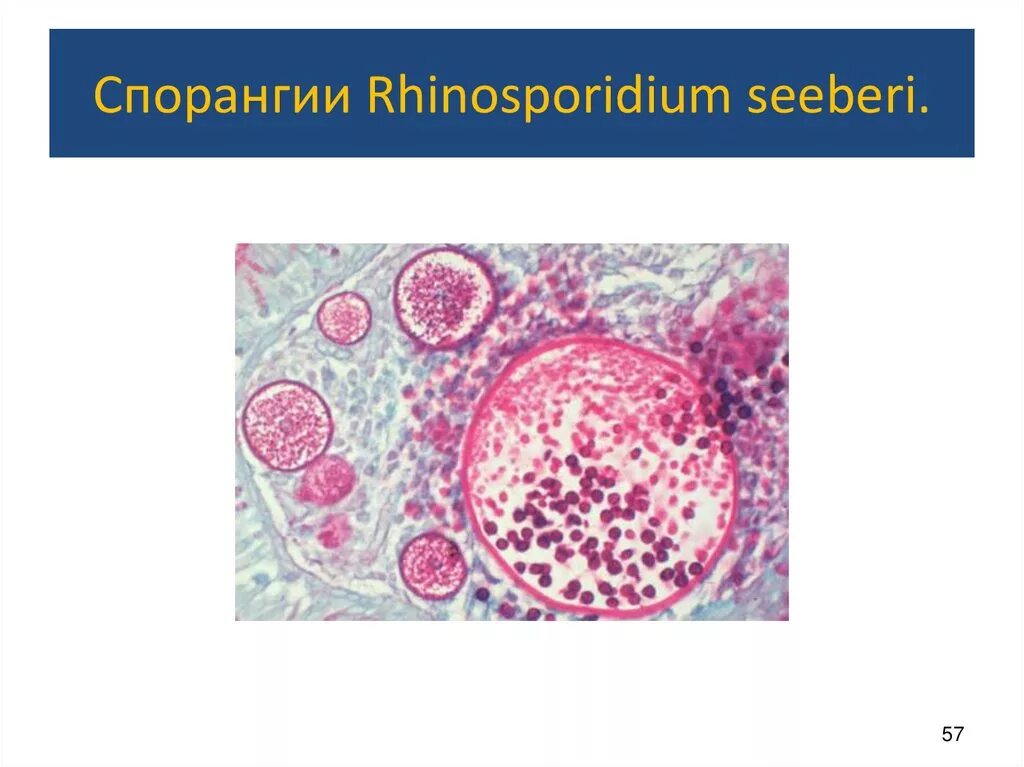 На молочнице грибок кандида. Кандидоз микробиология. Кандида альбиканс мицелий. Мицелий candida под микроскопом. Кандидоз микробиология.