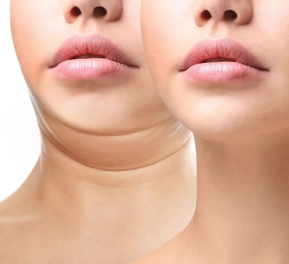 Пол подбородка. Подбородок у мужчин. Раздвоение подбородка. Двойной подбородок. Упражнени ялт второго подбородка.