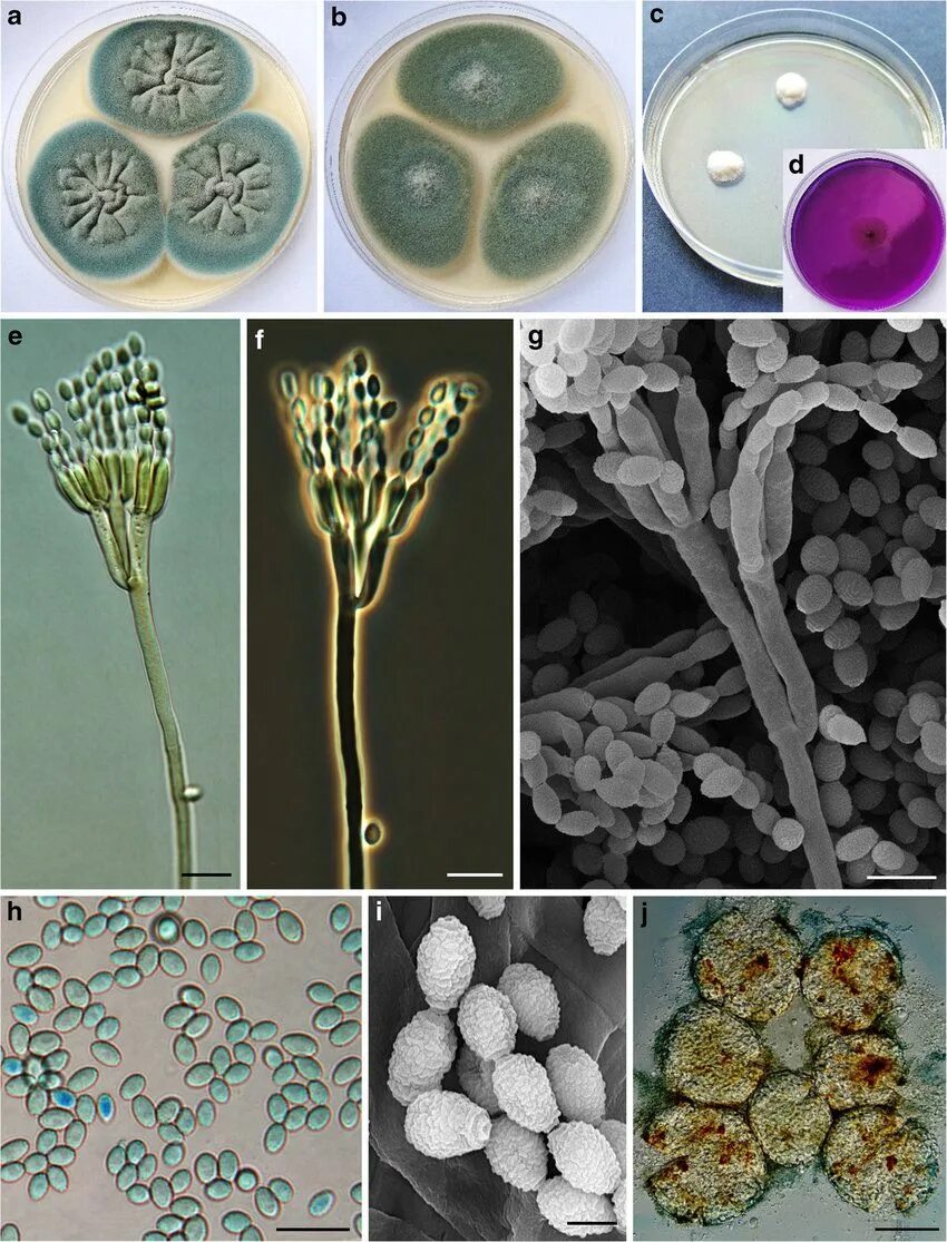 Микотоксины Penicillium. Эндемический пенициллиоз. Пенициллиум грибок микроскоп. Пенициллиоз (Penicilliosis). Плесневые грибы вирусы