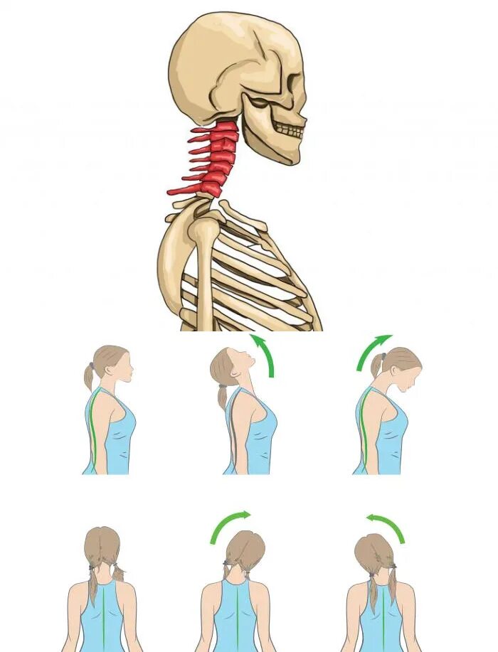 Больно поворачивать голову. Защемление спины и шеи. Упражнения при защемлении шейных нервов. Защемление шейного нерва.