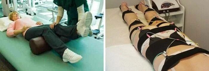 Тейпирование седалищного нерва. Йога от ишиаса. Массаж седалищного нерва. Физиотерапия седалищного нерва. Массаж при защемлении седалищного нерва.