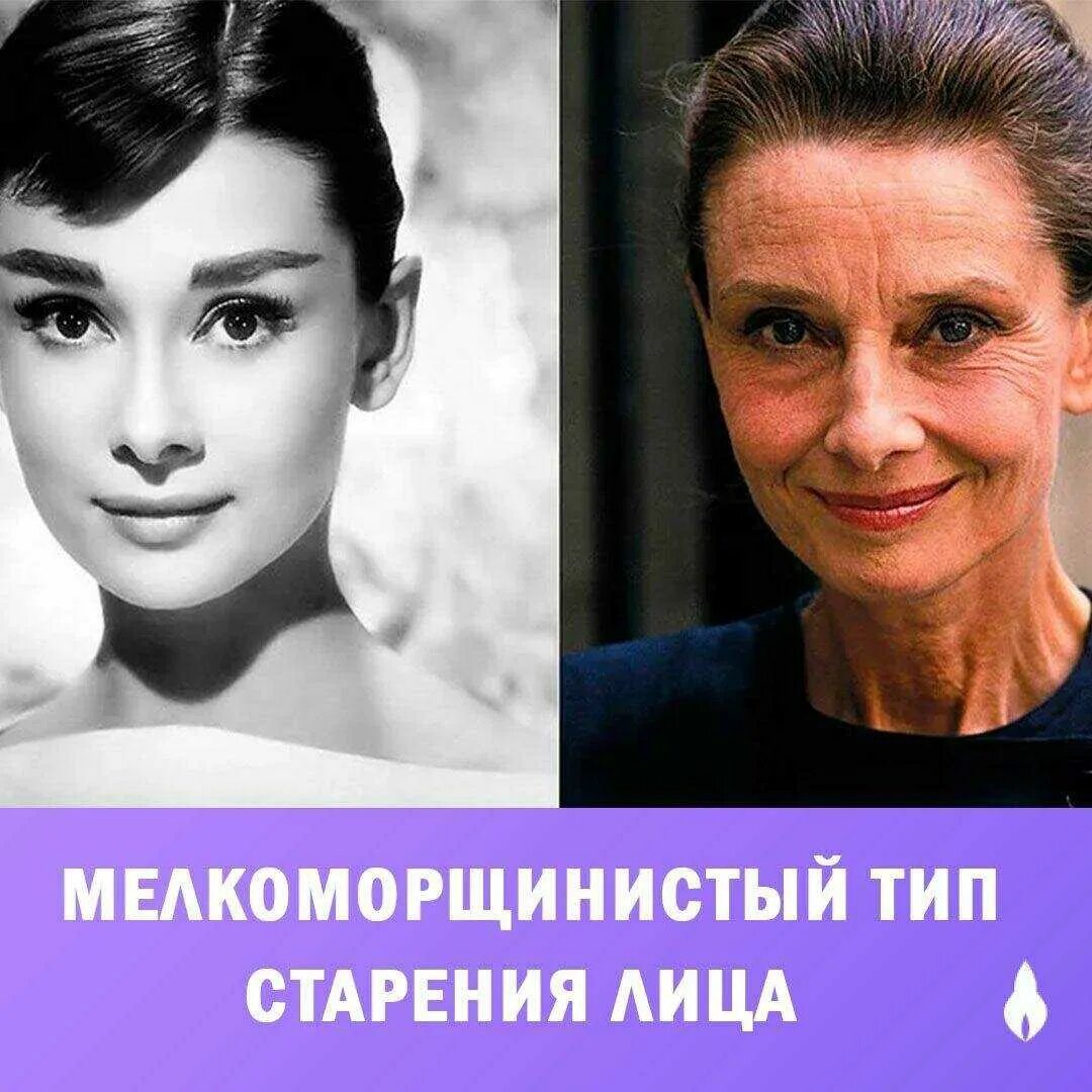 Старение усталое лицо. Одри Хепберн портрет. Мелкоморщинистый морфотип старения. Мелкоморщинистый и деформационный Тип старения.