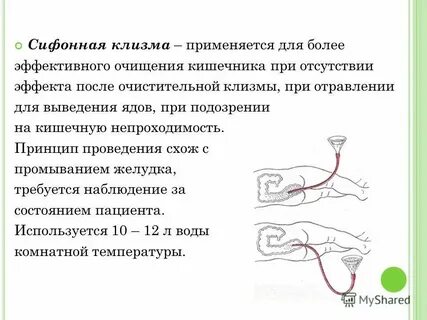 Что выходит после клизмы