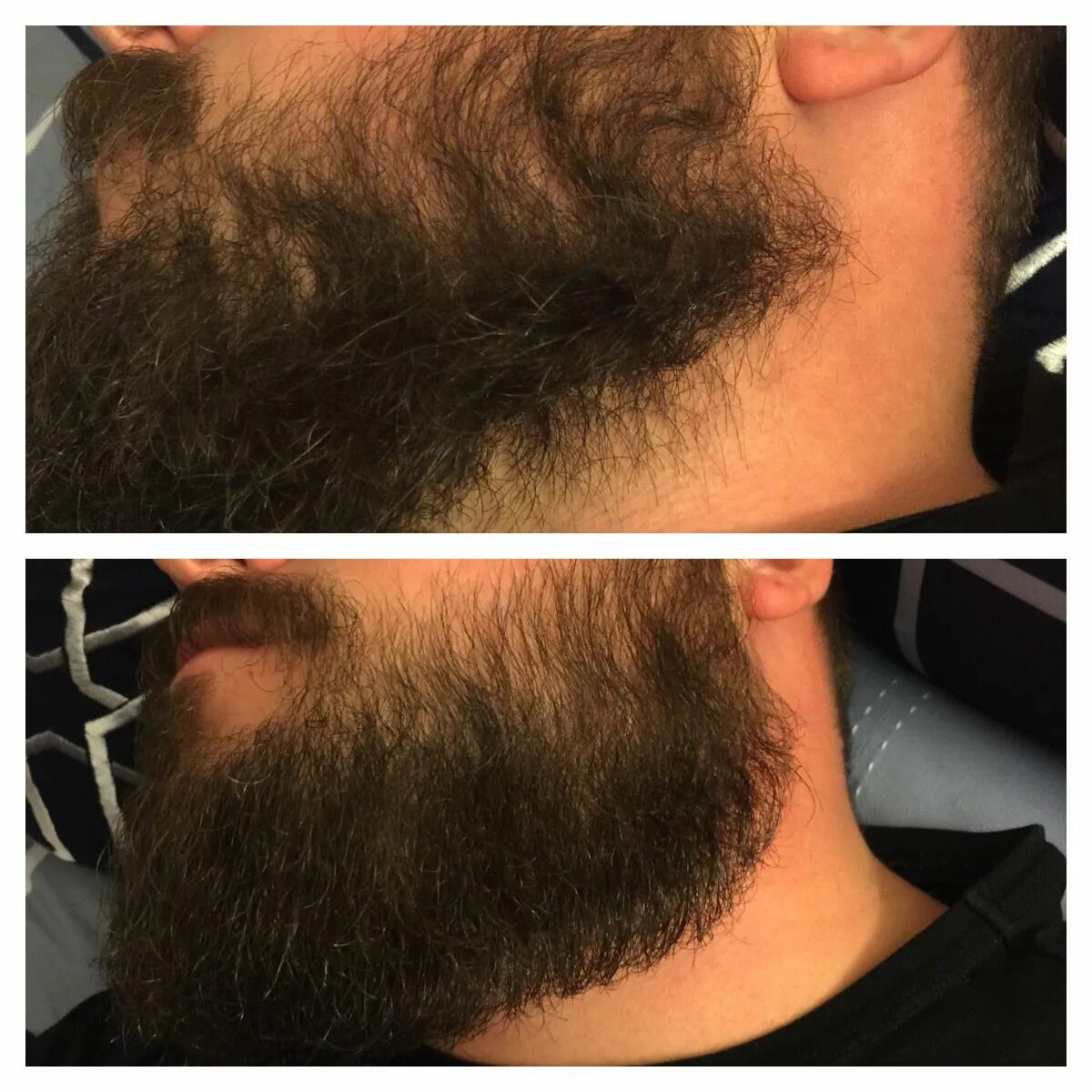 Выпрямление бороды. Выпрямитель для бороды до и после. Keratin для бороды что это. Выпрямление бороды кератином. Какие волосы на бороде