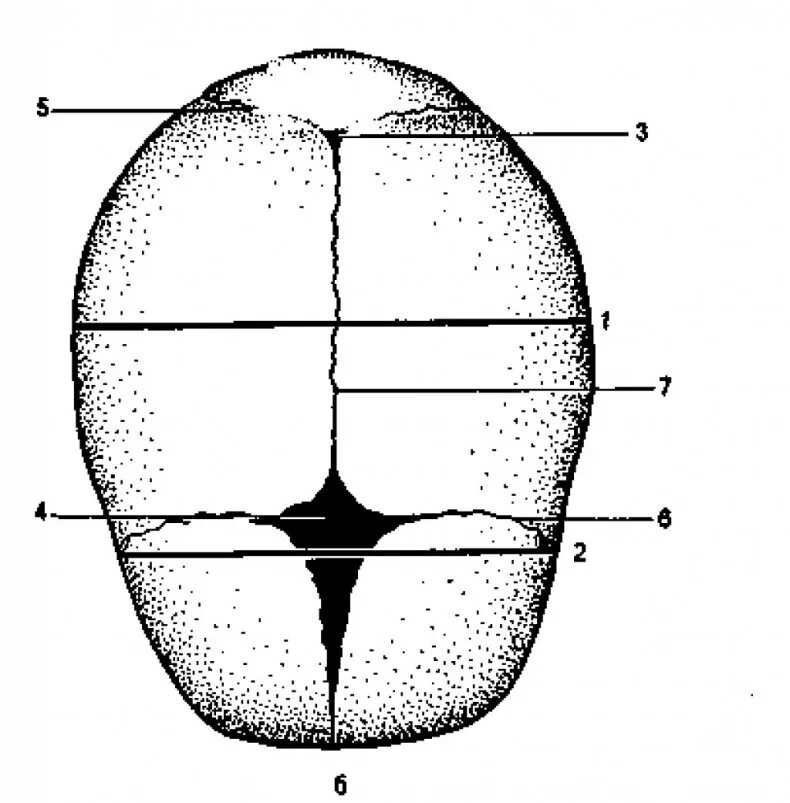 Строение головки плода швы роднички. Строение головки плода Акушерство. Сагиттальный шов черепа новорожденного. Роднички черепа плода.