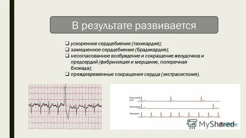 Пульс при всд. Ускорение пульса. ускоренное сердцебиение. тахикардия брадикардия аритмия. что замедляет сердцебиение.