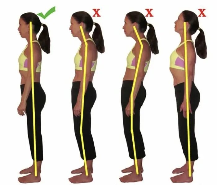 Искривление позвоночника лордоз. Правильная осанка позвоночника. Ровная правильная осанка. Правильная спина. Правильная поясница