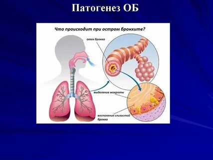 Этиология бронхита у детей