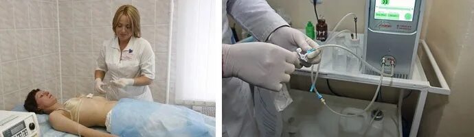 Введение озонированного физраствора