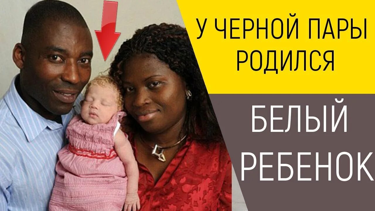 У белой пары родился черный. У белой пары родился черный ребенок. черный ребенок у белых родителей. у черно белой пары родятся черные.