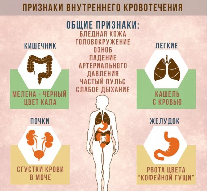 Симптомы при внутреннем кровотечении. Проявление внутреннего кровотечения. Внутреннее кровотечение сим. Призеаки внетрееего крово.