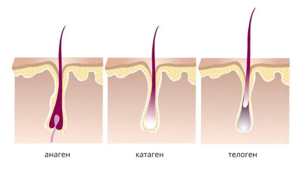 Растут корни волос. Фазы роста волос анаген катаген. Телоген фаза роста волос. Рост волос анаген катаген. Стадии роста волос анаген.
