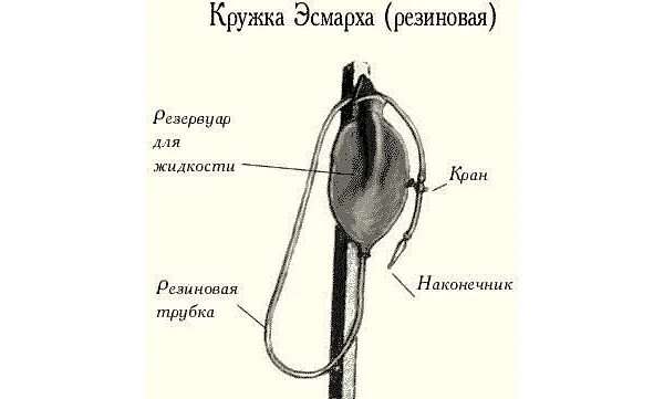 Кружка эсмарха применить. Постановка клизмы Кружка Эсмарха. Кружка Эсмарха строение. Строение кружки Эсмарха. Кружка Эсмарха схема.