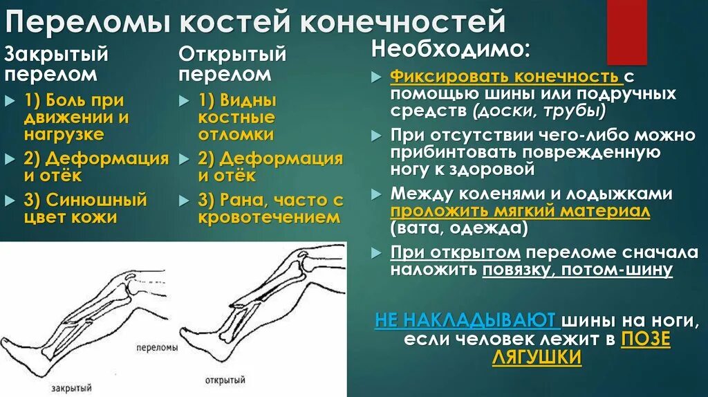 Признаки трещины. Переломы костей конечностей. Переломы нижних конечностей. Переломы костей нижних конечностей. Открытый перелом и закрытый перелом.