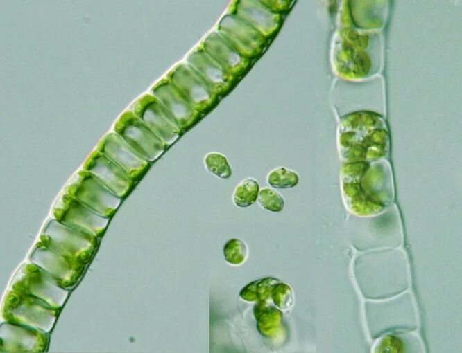 Многоклеточное слоевище. Улотрикс. Улотрикс опоясанный. Многоклеточные водоросли улотрикс. Ulothrix zonata.