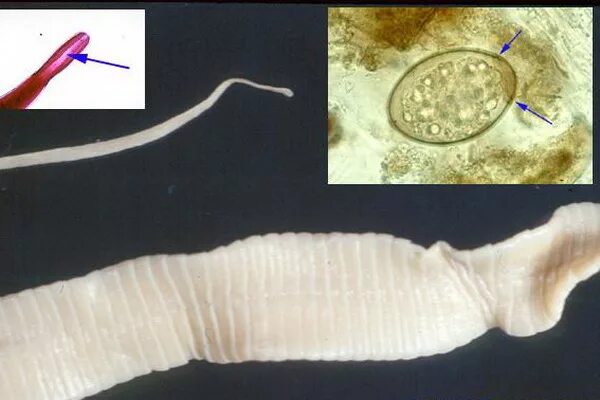 Ленточный червь у кошки. Широкий лентец (Diphyllobothrium latum). Цестоды, ленточные глисты.. Цестоды ленточные гельминты у кошек.