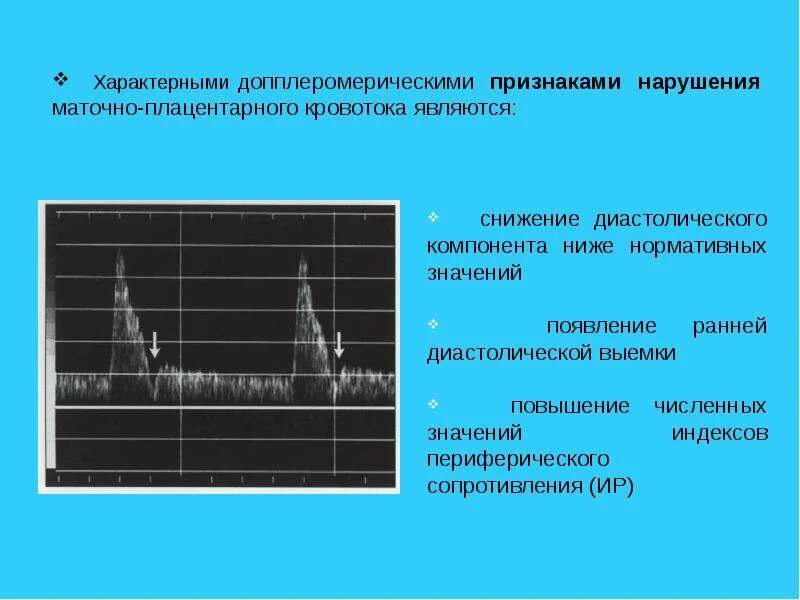 Допплерометрия плодового кровотока. Маточно плацентарный и плодово плацентарный кровоток 2 степени. Нарушение маточно-плацентарного кровотока классификация. Классификация нарушения маточно-плодово-плацентарного кровотока. Маточная гемодинамика