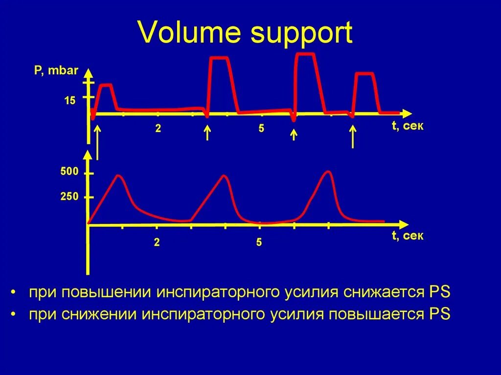 Графики ИВЛ. Инспираторная давление в ИВЛ. Инспираторная пауза на ИВЛ. Volume Control ИВЛ. Volume support