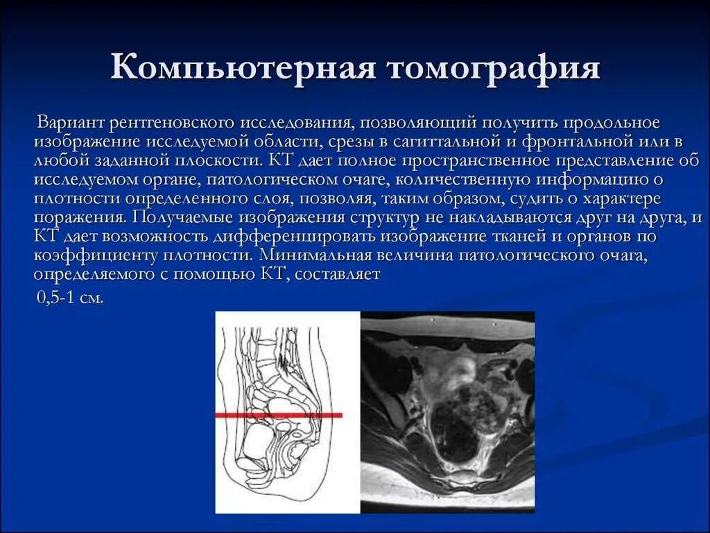 Кт обп омт с контрастированием