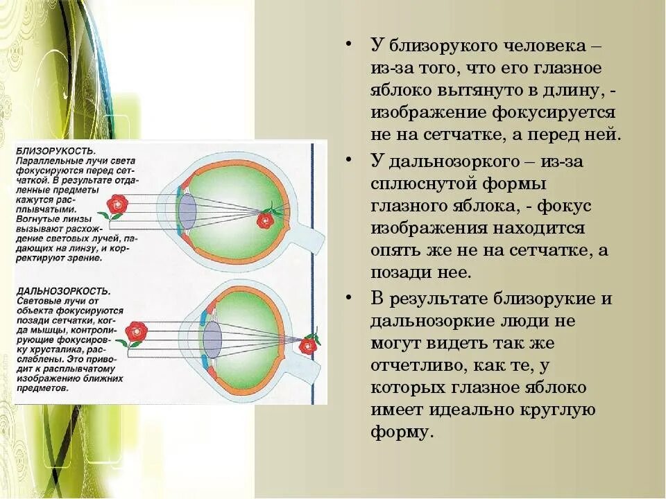 Прохождение луча света в глазном. Дальнозоркость и близорукость строение глаза. Форма глазного яблока при миопии. Строение глаза миопия. Близорукость схема строения глаза.