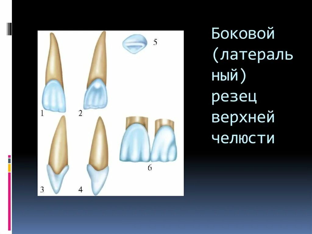 Резцы верхней челюсти поверхности