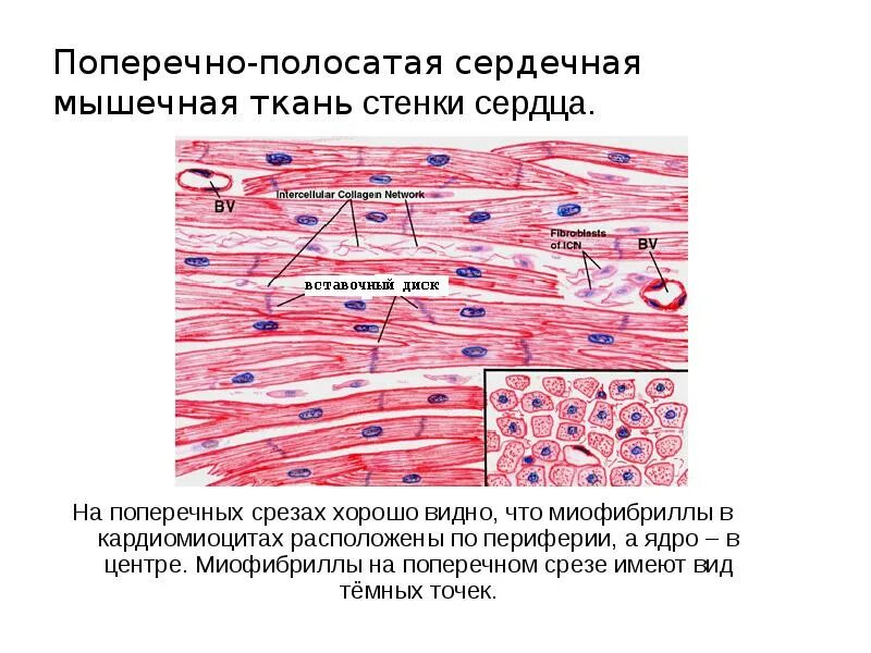 Строение поперечно полосатой сердечной ткани. Строение сердечно поперечно полосатой мышечной ткани. Поперечно-полосатая ткань сердечной мышцы. Поперечно полосатая сердечная ткань гистология.