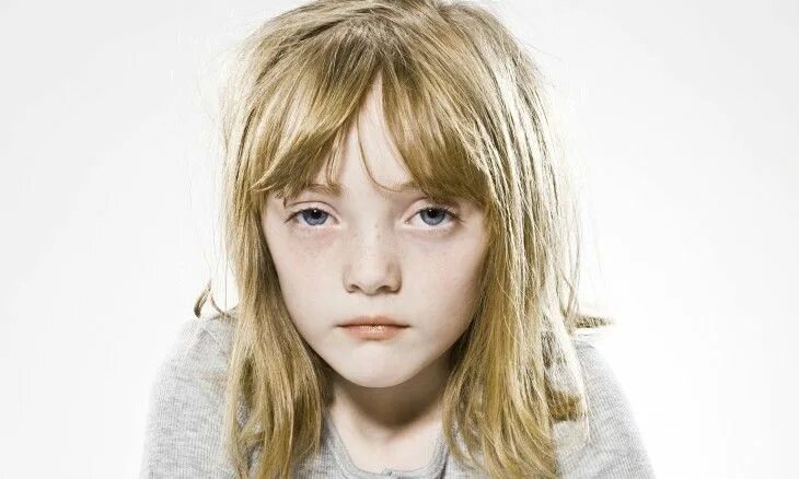 58 Albino People Who’ll Mesmerize You With Their Otherworldly Beauty Albinism, A