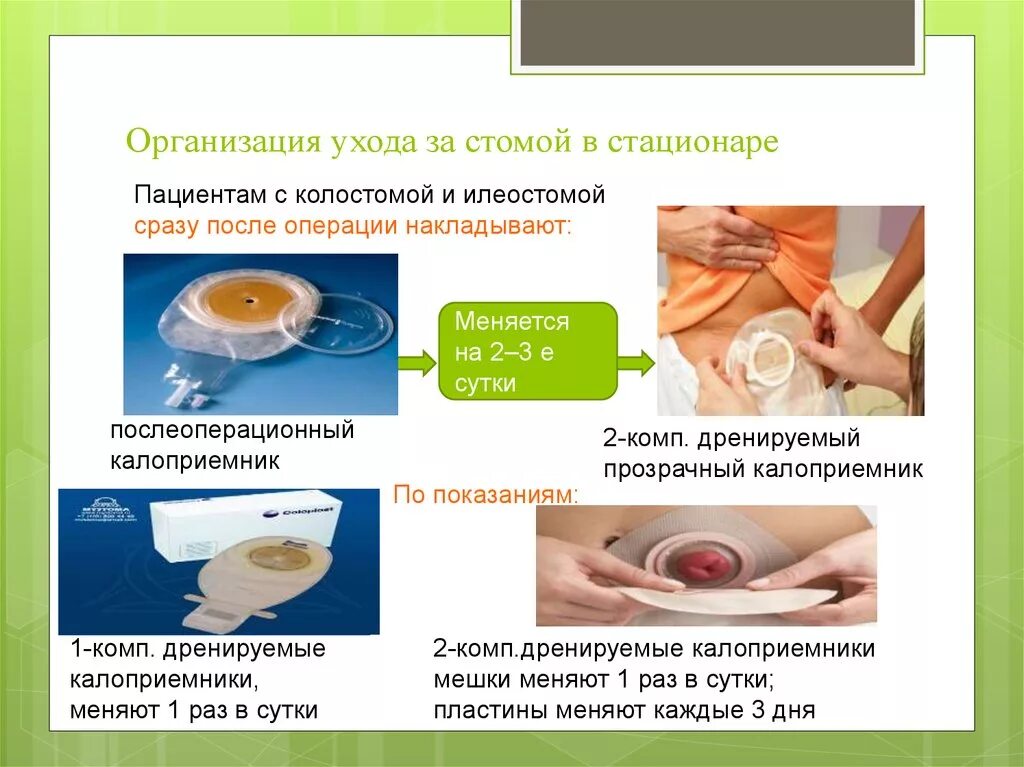 Обработка колостомы и смена калоприемника алгоритм. Алгоритм промывания колостомы. Постановка стомы алгоритм. Рекомендации пациентам после операции