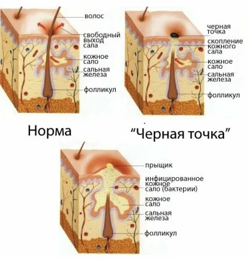 Кожа нету