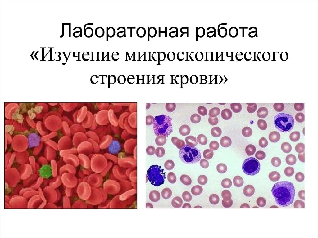 Цитоплазма эритроцитов человека. Изучение микроскопического строения крови. Строение эритроцитов биология 8 класс. Изучение клеток крови человека и лягушки. Лабораторная работа по биологии 8 класс кровь человека и лягушки.