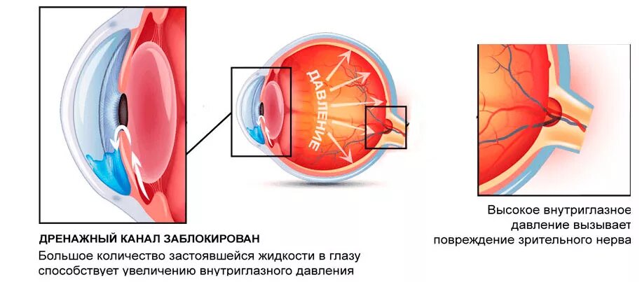 Глазное давление после 70 лет. Глаукома норма внутриглазного давления. Нормальное внутриглазное давление при глаукоме. Показатели внутриглазного давления при глаукоме. Давление внутриглазного дна норма.