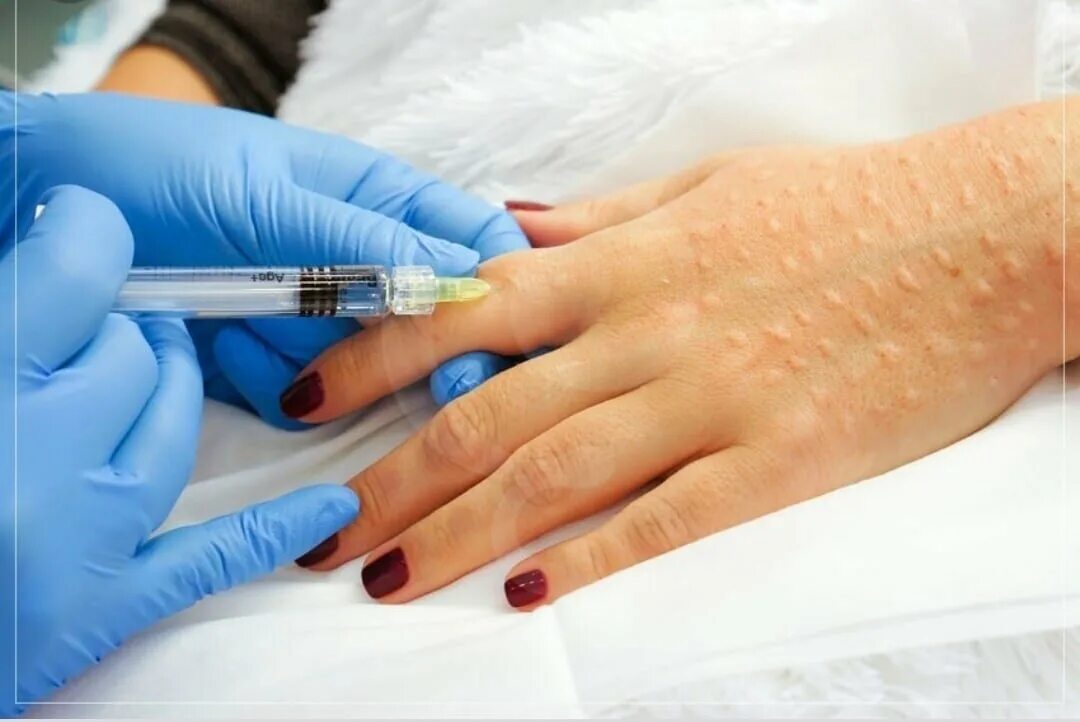 патентованные пробирки plasmolifting. плазмолифтинг лаеннек. биоревитализация кожи рук. плазмолифтинг рук. биоревитализация кистей рук.