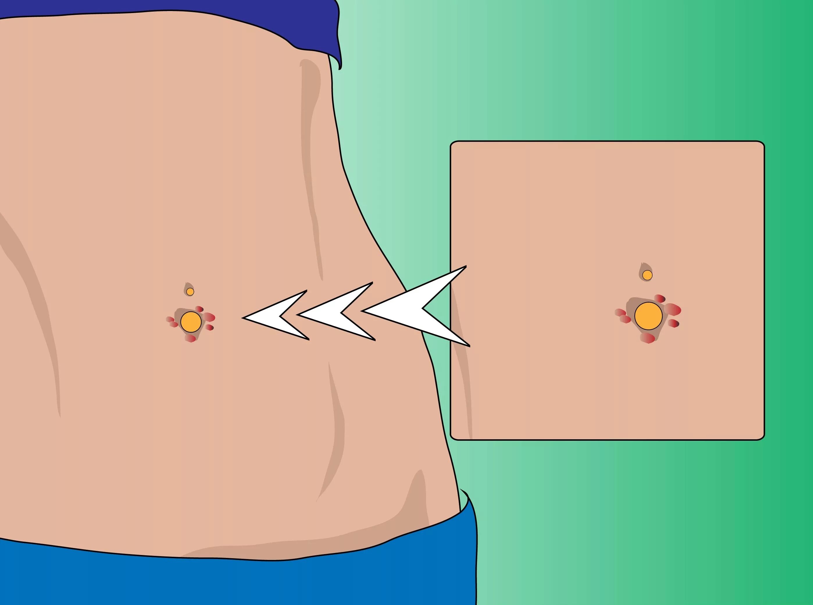 Грелка для пупка. Пупки нужно чистить. Куриные желудки желтая пленка. Пупки нужно чистить. Пупки нужно чистить.