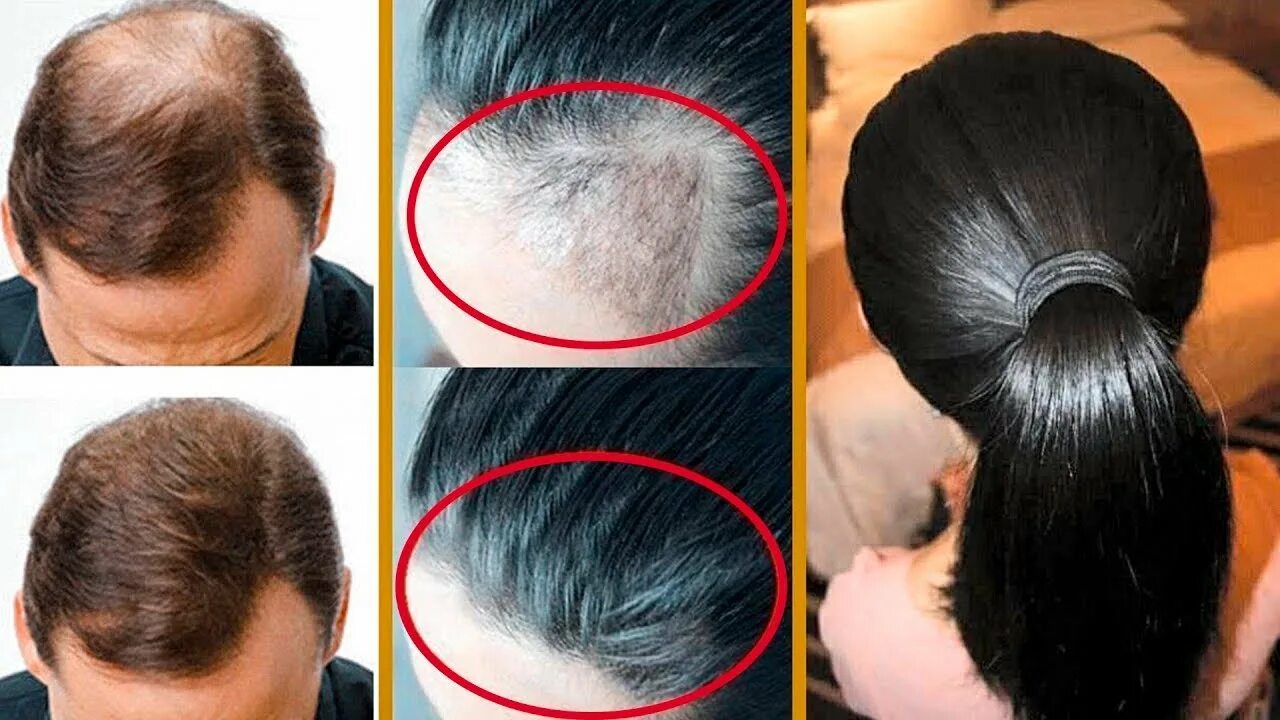 отрасти макушку волос