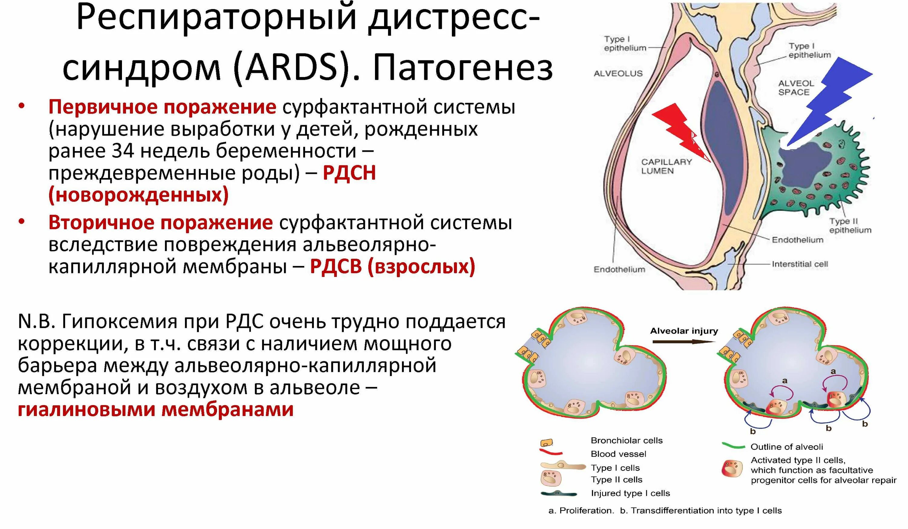 Респираторный дистресс синдром взрослых. Респираторный дистресс синдром. Синдром дыхательных расстройств у новорожденных патогенез. Респираторный дистресс-синдром (РДС. Респираторный дистресс синдром патанатомия.