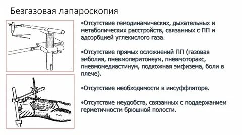Когда снимают чулки после операции лапароскопии