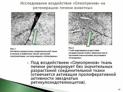 Регенерация печени
