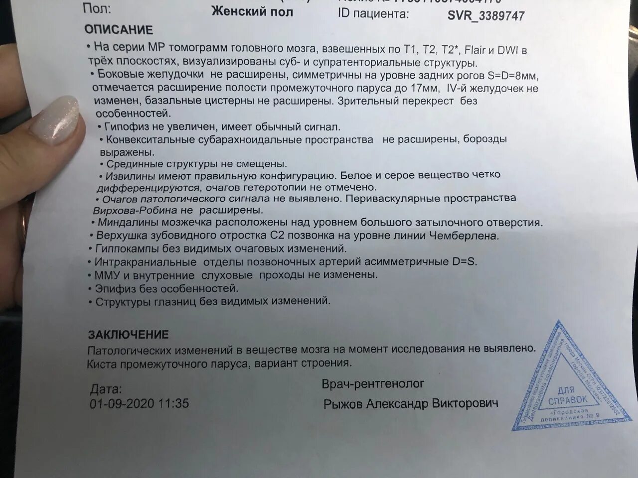 Чем опасна киста в мозгу. Киста промежуточного паруса головного мозга Размеры. Мрт головного мозга заключение. Киста промежуточного паруса у плода. Киста промежуточного паруса на УЗИ.