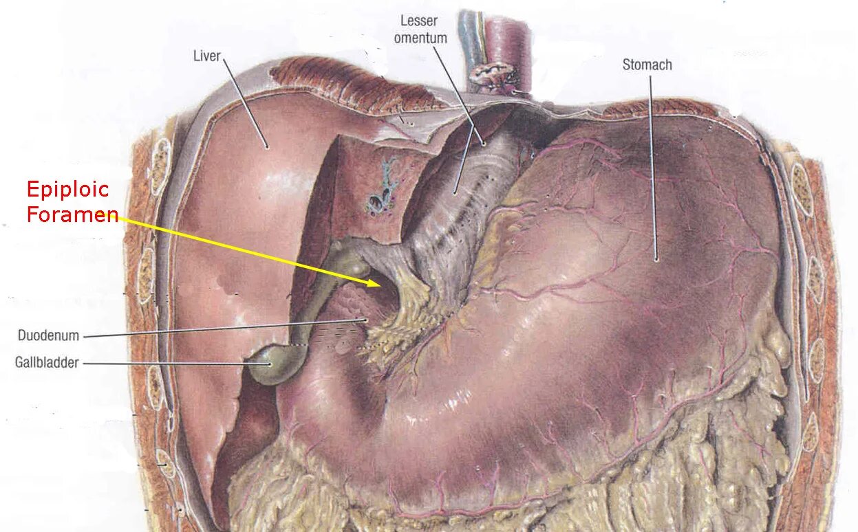Сальниковая сумка брюшины анатомия. Печеночная сумка преджелудочная сумка сальниковая сумка. Печеночная преджелудочная и сальниковая сумки. Сальниковая сумка – Bursa Omentalis. Отверстие в печени