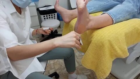 Подология видео