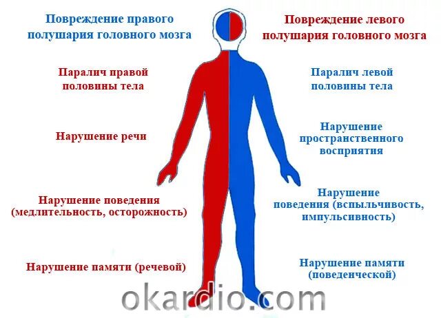 Поражение половины мозга. Осложнения после ишемического инсульта. Ишемический инсульт последствия. Геморрагический инсульт что это такое и последствия. Осложнения геморрагического инсульта.