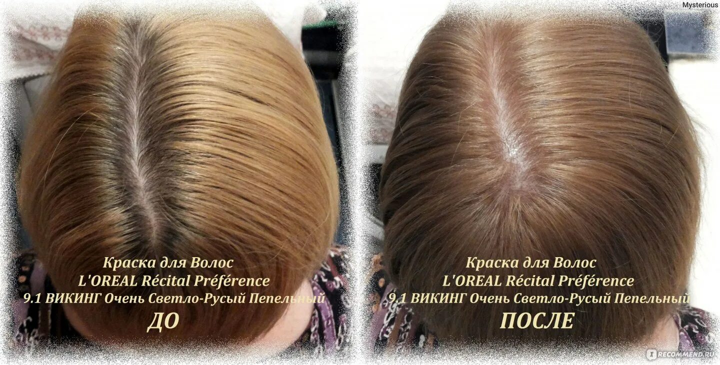 9 1 викинг. 1. 1 викинг. 1 викинг. 1 викинг лореаль на темных.