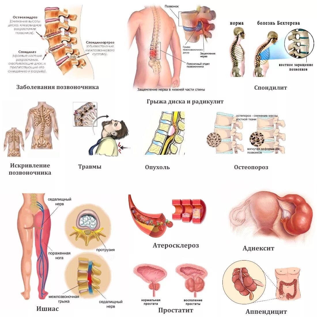 Люмбоишиалгия карта вызова. Причины боли в спине. Боли в спине внутренние органы. Причины болей в спине внутренние органы. Почему болит поясница.
